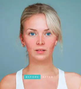 Plastic Surgery in Nashik