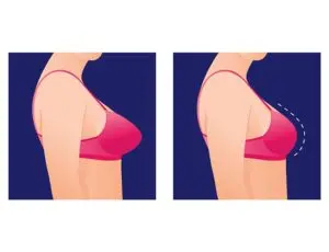 Plastic Surgery in Nashik