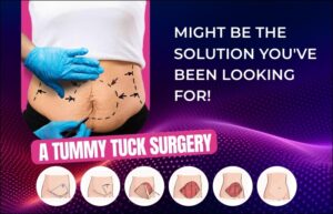 Fat reduce surgery in Nashik